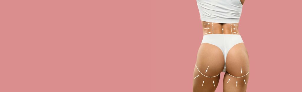 Woman in white undergarments showing butt lift result