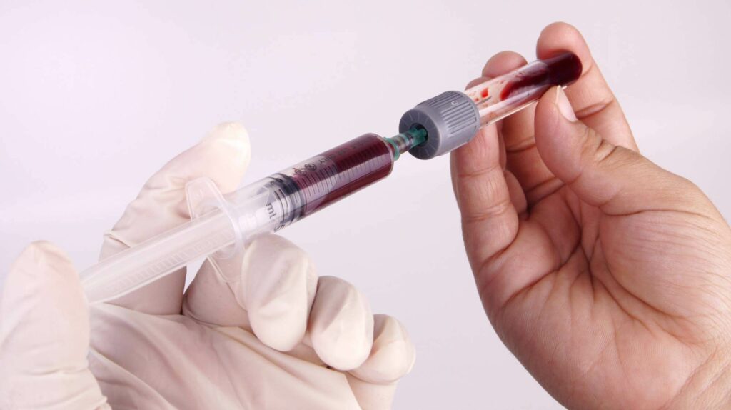 Close-up of gloved hands drawing blood from a vial using a syringe