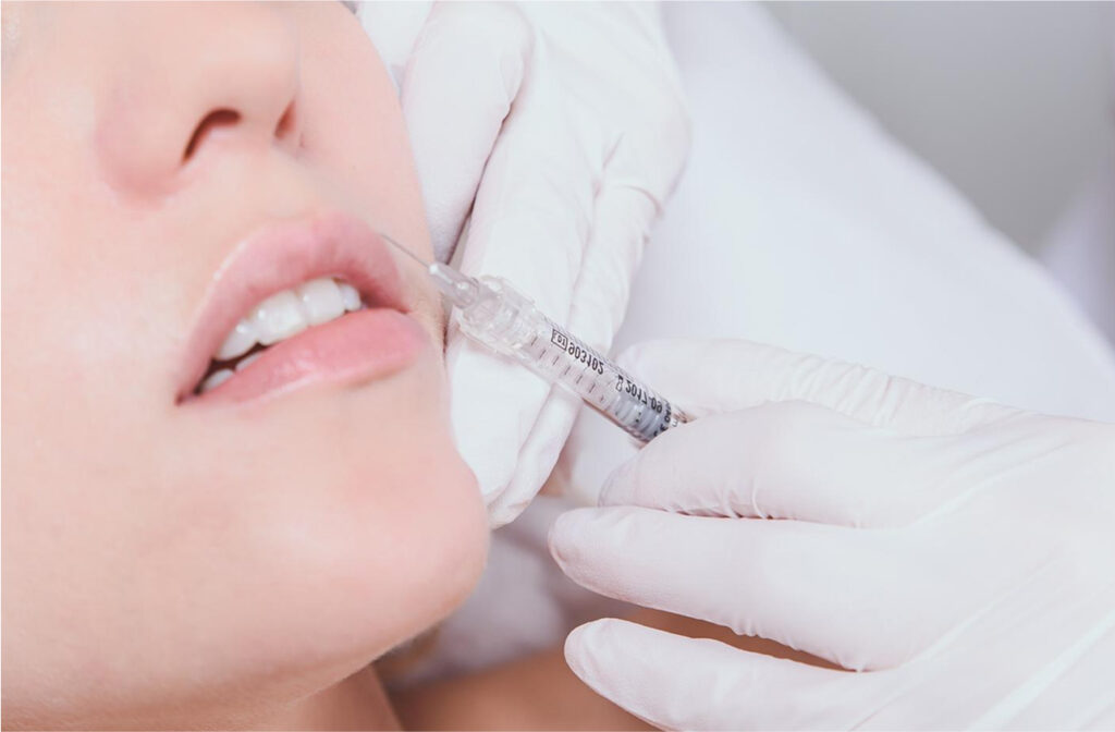 Close-up of a woman receiving a dermal filler injection to reduce facial wrinkles, highlighting the treatment process.