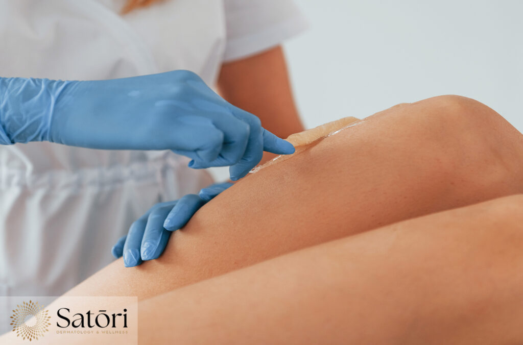Dermatologist applying non-surgical cream onto a patient's skin during a skincare treatment.