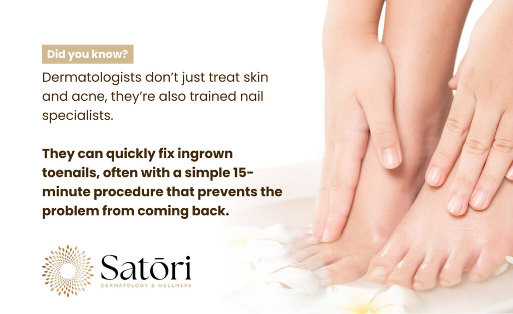 Dermatologist care helps fix painful ingrown toenails quickly.