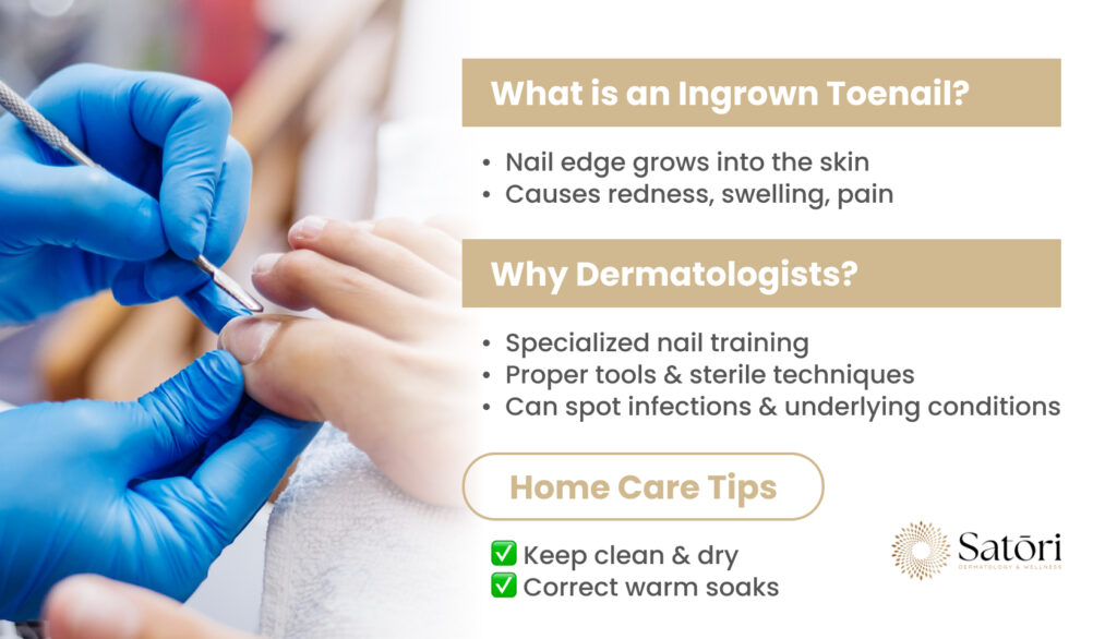 Dermatologist treating ingrown toenail with sterile tools.