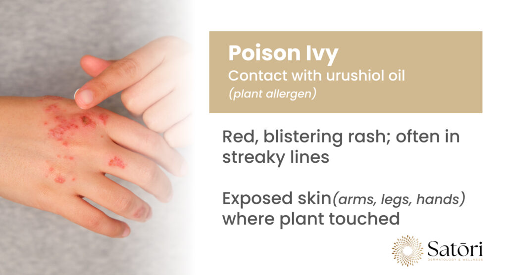 Poison Ivy