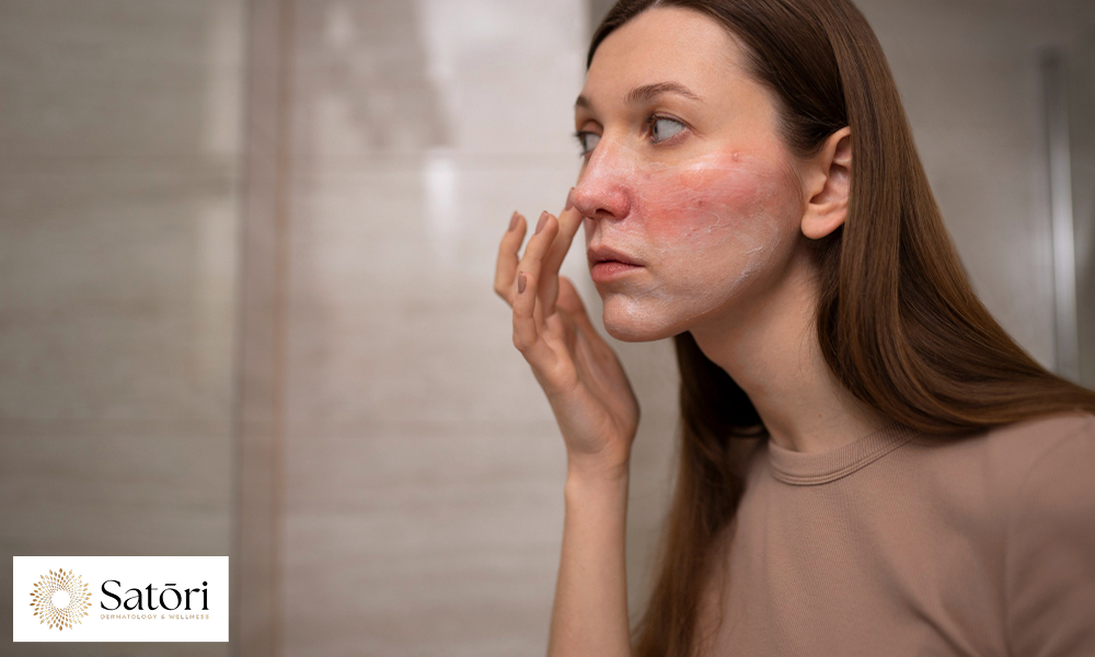 Woman looking at her rosacea in the mirror