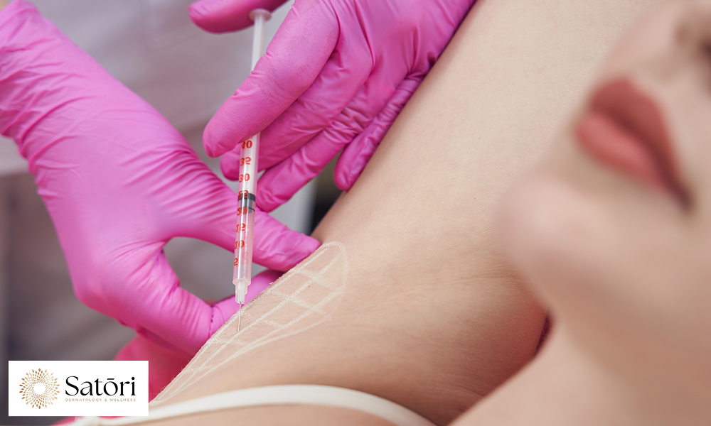 Doctor giving Botox injection in underarm to reduce excessive sweating.