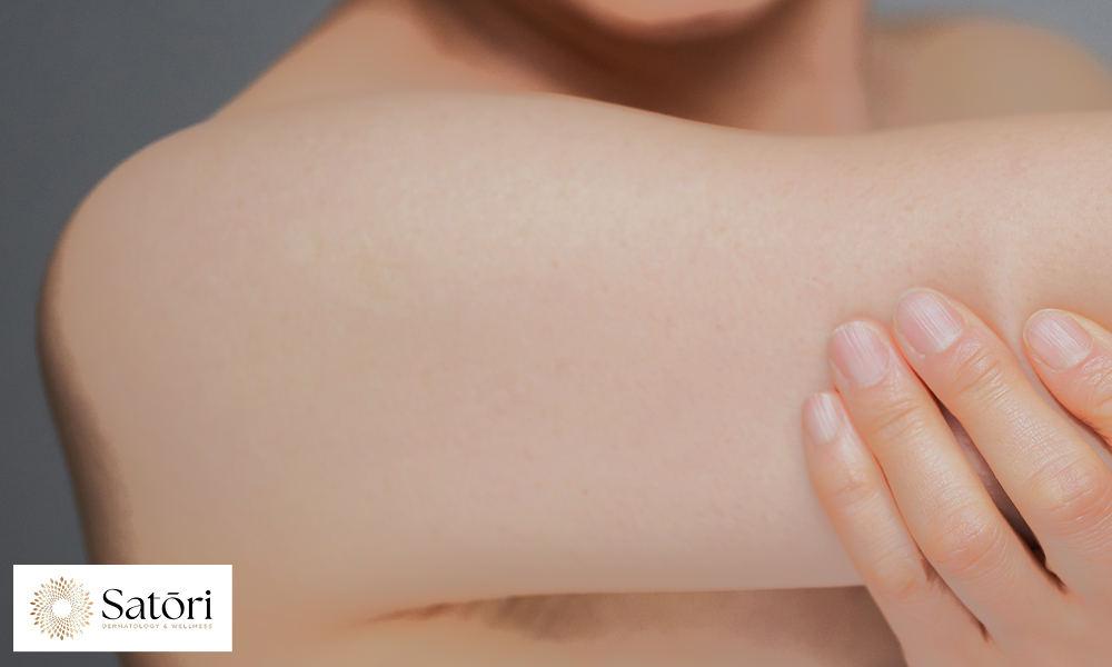 Close-up of smooth, healthy skin on a woman’s arm in her 30s.