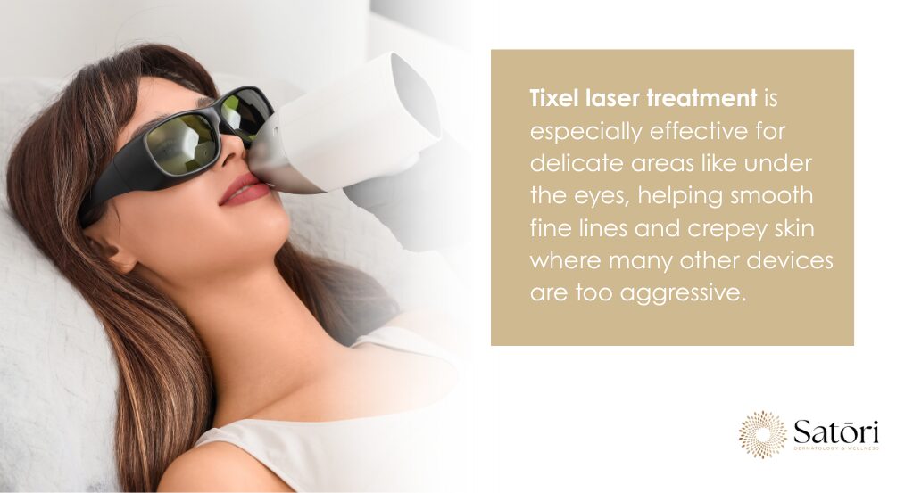 Woman wearing protective goggles receives Tixel laser treatment near the eyes, with a callout about smoothing under-eye fine lines and crepey skin.
