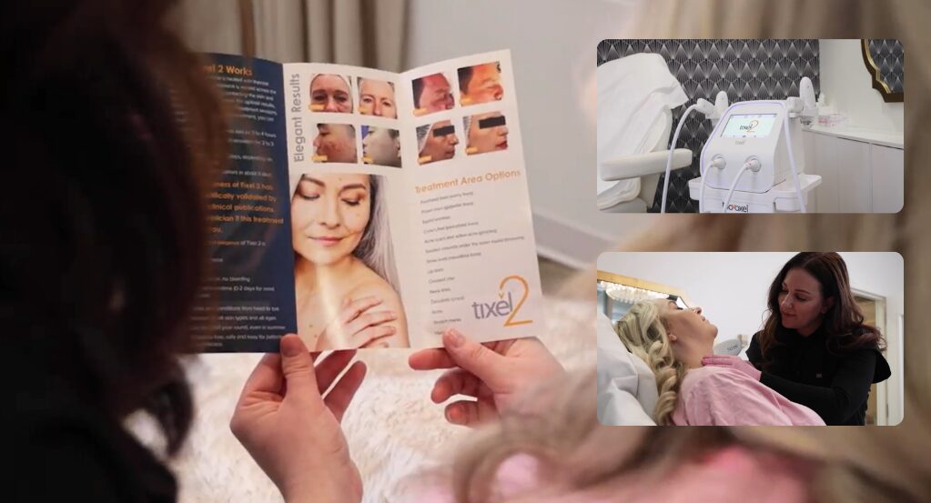 Person holding a Tixel 2 skin resurfacing brochure with before-and-after photos, with inset images showing the Tixel device and a provider treating a patient.